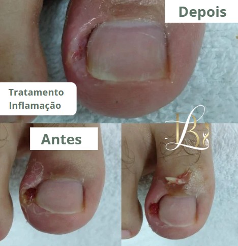 Infeccao.jpg